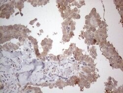 C19ORF80 Monoclonal Antibody (OTI4G8), TrueMAB , OriGene 100 &mu;L; Unconjugated:Antibodies,