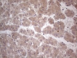 C19ORF80 Monoclonal Antibody (OTI4G8), TrueMAB , OriGene:Antibodies:Primary