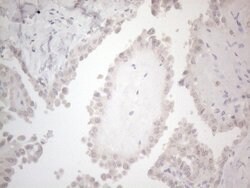 C19ORF80 Monoclonal Antibody (OTI1C6), TrueMAB , OriGene 100 &mu;L; Unconjugated:Antibodies,