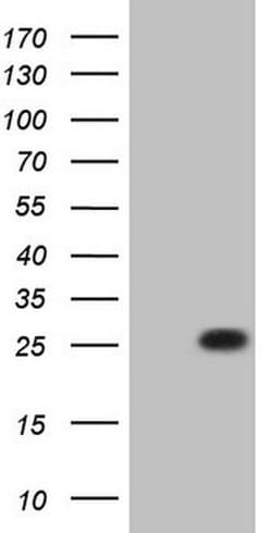 C19ORF80 Monoclonal Antibody (OTI5A2), TrueMAB , OriGene:Anticuerpos:Anticuerpos