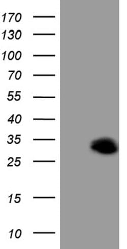 C19ORF80 Mouse anti-Human, Clone: OTI6F7, lyophilized, TrueMAB 100 &mu;g | Buy Online | OriGene | Fisher Scientific