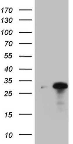 C19ORF80 Monoclonal Antibody (OTI5A4), TrueMAB , OriGene 100 &mu;L; Unconjugated:Antibodies,