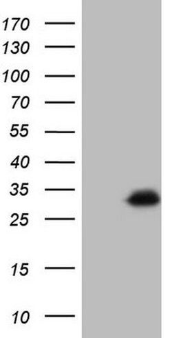 C19ORF80 Monoclonal Antibody (OTI1C6), TrueMAB , OriGene 100 &mu;L; Unconjugated:Antibodies,