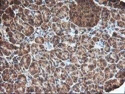 C1S Mouse anti-Human, Clone: OTI2D11, liquid, TrueMAB 100 &mu;L; Unconjugated:Antibodies,