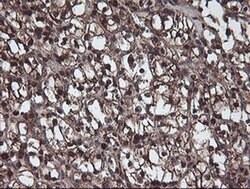 C1S Mouse anti-Human, Clone: OTI2D11, liquid, TrueMAB 100 &mu;L; Unconjugated:Antibodies,
