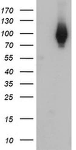 C1S Mouse anti-Human, Clone: OTI2D11, liquid, TrueMAB 100 &mu;L; Unconjugated:Antibodies,