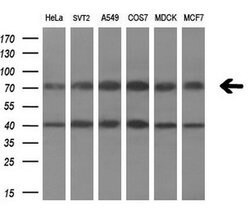 C1S Mouse anti-Human, Clone: OTI2D11, liquid, TrueMAB 100 &mu;L; Unconjugated:Antibodies,