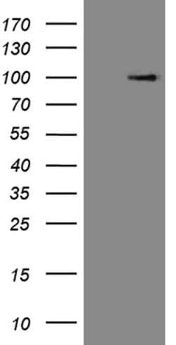 C1orf106 Monoclonal Antibody (OTI14A10), TrueMAB , OriGene 100 &mu;L; Unconjugated:Antibodies,