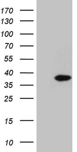 C1orf111 Mouse anti-Human, Clone: OTI2F3, lyophilized, TrueMAB 100 &mu;g;