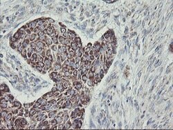 C1orf151 Mouse anti-Human, Clone: OTI4H7, lyophilized, TrueMAB 100 &mu;g;