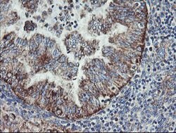 C1orf151 Mouse anti-Human, Clone: OTI4H7, lyophilized, TrueMAB 100 &mu;g;