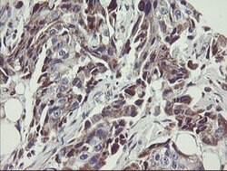 C1orf151 Mouse anti-Human, Clone: OTI4H7, lyophilized, TrueMAB 100 &mu;g;