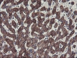 C1orf151 Mouse anti-Human, Clone: OTI4H7, lyophilized, TrueMAB 100 &mu;g;