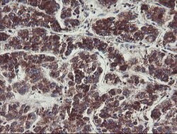 C1orf151 Mouse anti-Human, Clone: OTI4H7, lyophilized, TrueMAB 100 &mu;g;