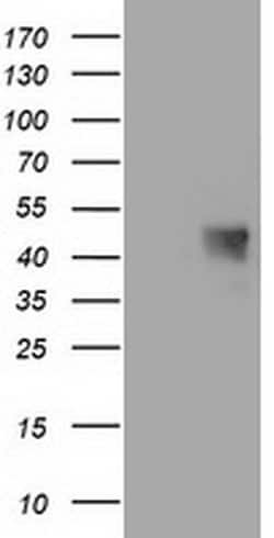 C1orf161 Monoclonal Antibody (OTI1F6), TrueMAB , OriGene 30 &mu;L; Unconjugated:Antibodies,