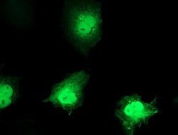 C1orf50 Monoclonal Antibody (OTI4D10), TrueMAB , OriGene:Antibodies:Primary