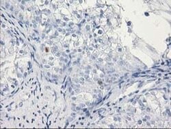 C1orf50 Monoclonal Antibody (OTI1B11), TrueMAB , OriGene 100 &mu;L; Unconjugated:Antibodies,