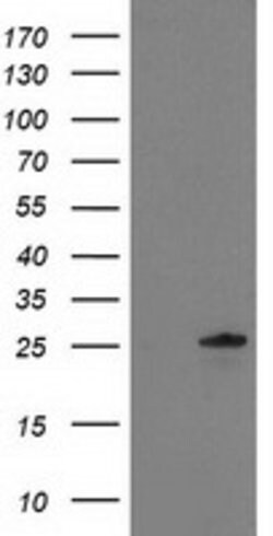 C1orf50 Mouse anti-Human, Clone: OTI1B11, lyophilized, TrueMAB 100 &mu;g | Buy Online | Origene Technologies | Fisher Scientific