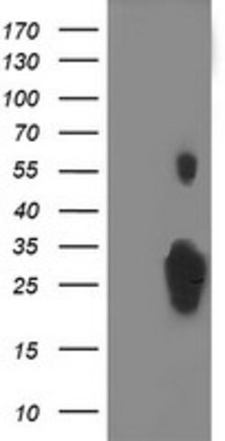 C1orf50 Mouse anti-Human, Clone: OTI4D10, lyophilized, TrueMAB 100 &mu;g;