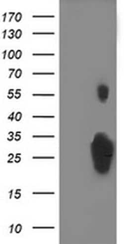 C1orf50 Monoclonal Antibody (OTI4D10), TrueMAB , OriGene 100 &mu;L; Unconjugated:Antibodies,