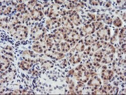 C20orf3 Mouse anti-Human, Clone: OTI1G8, lyophilized, TrueMAB 100 &mu;g;