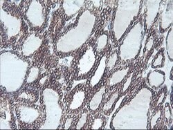 C20orf3 Monoclonal Antibody (OTI1A9), TrueMAB , OriGene 30 &mu;L; Unconjugated:Antibodies,