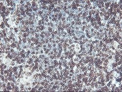 C20orf3 Monoclonal Antibody (OTI1A9), TrueMAB , OriGene 30 &mu;L; Unconjugated:Antibodies,