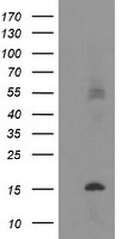 C20orf30 Monoclonal Antibody (OTI3B2), TrueMAB , OriGene 30 &mu;L | Buy Online | OriGene | Fisher Scientific