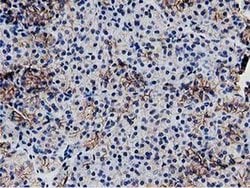 C20orf43 Monoclonal Antibody (OTI1E8), TrueMAB , OriGene 30 &mu;L; Unconjugated:Antibodies,