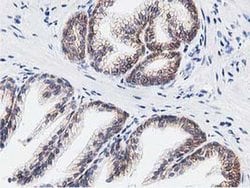 C20orf43 Monoclonal Antibody (OTI1E8), TrueMAB , OriGene 30 &mu;L; Unconjugated:Antibodies,