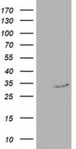 C20orf43 Monoclonal Antibody (OTI3A5), TrueMAB , OriGene 30 &mu;L; Unconjugated:Antibodies,
