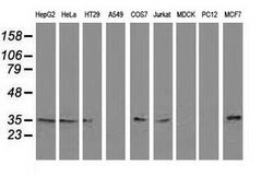 C20orf43 Mouse anti-Human, Clone: OTI3A5, lyophilized, TrueMAB 100 &mu;g;