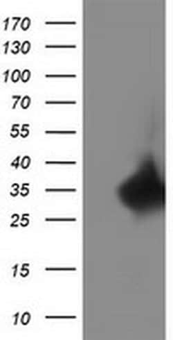C20orf43 Monoclonal Antibody (OTI1E8), TrueMAB , OriGene 30 &mu;L; Unconjugated:Antibodies,