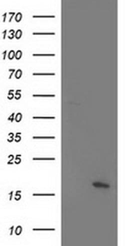 C21orf34 Monoclonal Antibody (OTI5D1), TrueMAB , OriGene 100 &mu;L; Unconjugated:Antibodies,