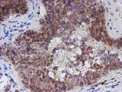C21orf56 Monoclonal Antibody (OTI1H6), TrueMAB , OriGene 30 &mu;L; Unconjugated:Antibodies,