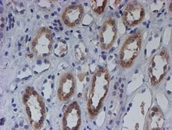 C21orf56 Monoclonal Antibody (OTI1H6), TrueMAB , OriGene:Antibodies:Primary