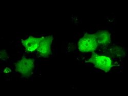 C21orf59 Monoclonal Antibody (OTI2H5), TrueMAB , OriGene 100 μL; Unconjugated:Antibodies,