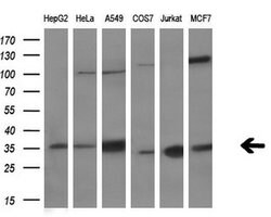 C21orf59 Monoclonal Antibody (OTI2H5), TrueMAB , OriGene 100 μL; Unconjugated:Antibodies,