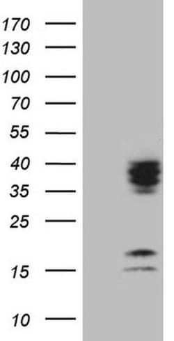 C21orf62 Monoclonal Antibody (OTI6C2), TrueMAB , OriGene 100 &mu;L; Unconjugated:Antibodies,