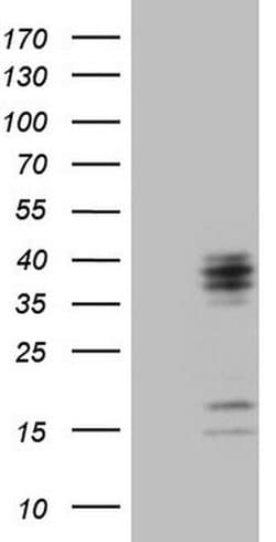 C21orf62 Monoclonal Antibody (OTI1B8), TrueMAB , OriGene 100 &mu;L | Buy Online | OriGene | Fisher Scientific