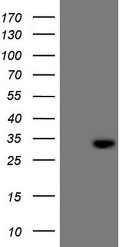 C21orf62 Monoclonal Antibody (OTI4A6), TrueMAB , OriGene 30 &mu;L; Unconjugated:Antibodies,