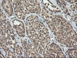 C2orf62 Monoclonal Antibody (OTI2E6), TrueMAB , OriGene 30 &mu;L; Unconjugated:Antibodies,
