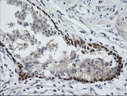 C2orf62 Monoclonal Antibody (OTI2E6), TrueMAB , OriGene:Antibodies:Primary