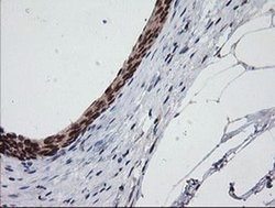 C2orf62 Monoclonal Antibody (OTI2E6), TrueMAB , OriGene 30 &mu;L; Unconjugated:Antibodies,