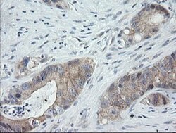 C2orf62 Monoclonal Antibody (OTI4B4), TrueMAB , OriGene 30 &mu;L; Unconjugated:Antibodies,
