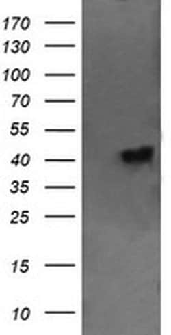 C2orf62 Monoclonal Antibody (OTI2E6), TrueMAB , OriGene:Antibodies:Primary