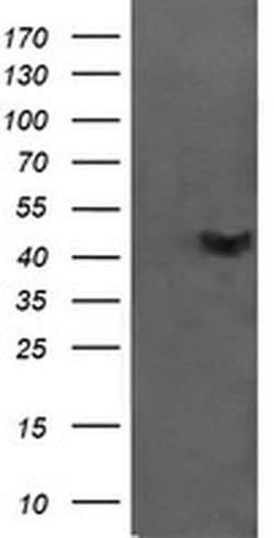 C2orf62 Monoclonal Antibody (OTI4B4), TrueMAB , OriGene 30 &mu;L; Unconjugated:Antibodies,