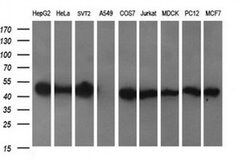 C2orf62 Monoclonal Antibody (OTI4B4), TrueMAB , OriGene:Antibodies:Primary