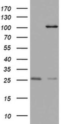 C3orf15 Monoclonal Antibody (OTI6G1), TrueMAB , OriGene 100 &mu;L; Unconjugated:Antibodies,