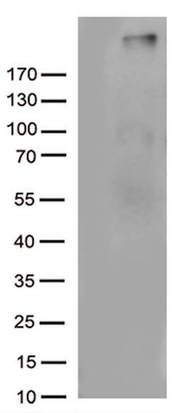 C4B Mouse anti-Human, Clone: OTI1B2, lyophilized, TrueMAB 100 &mu;g; Unconjugated:Antibodies,